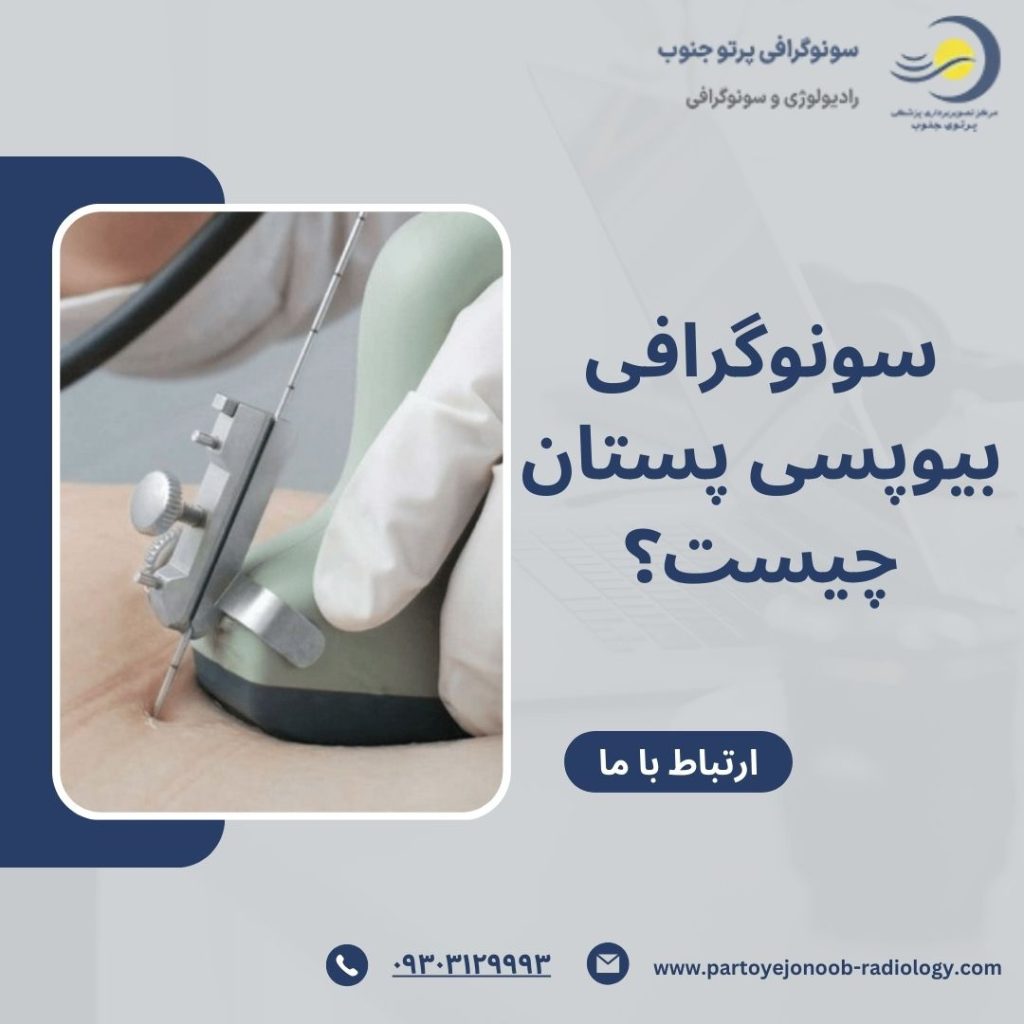 سونوگرافی بیوپسی پستان