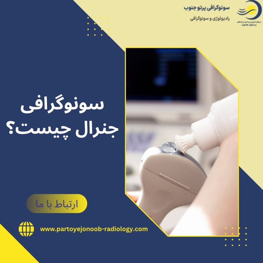 سونوگرافی جنرال