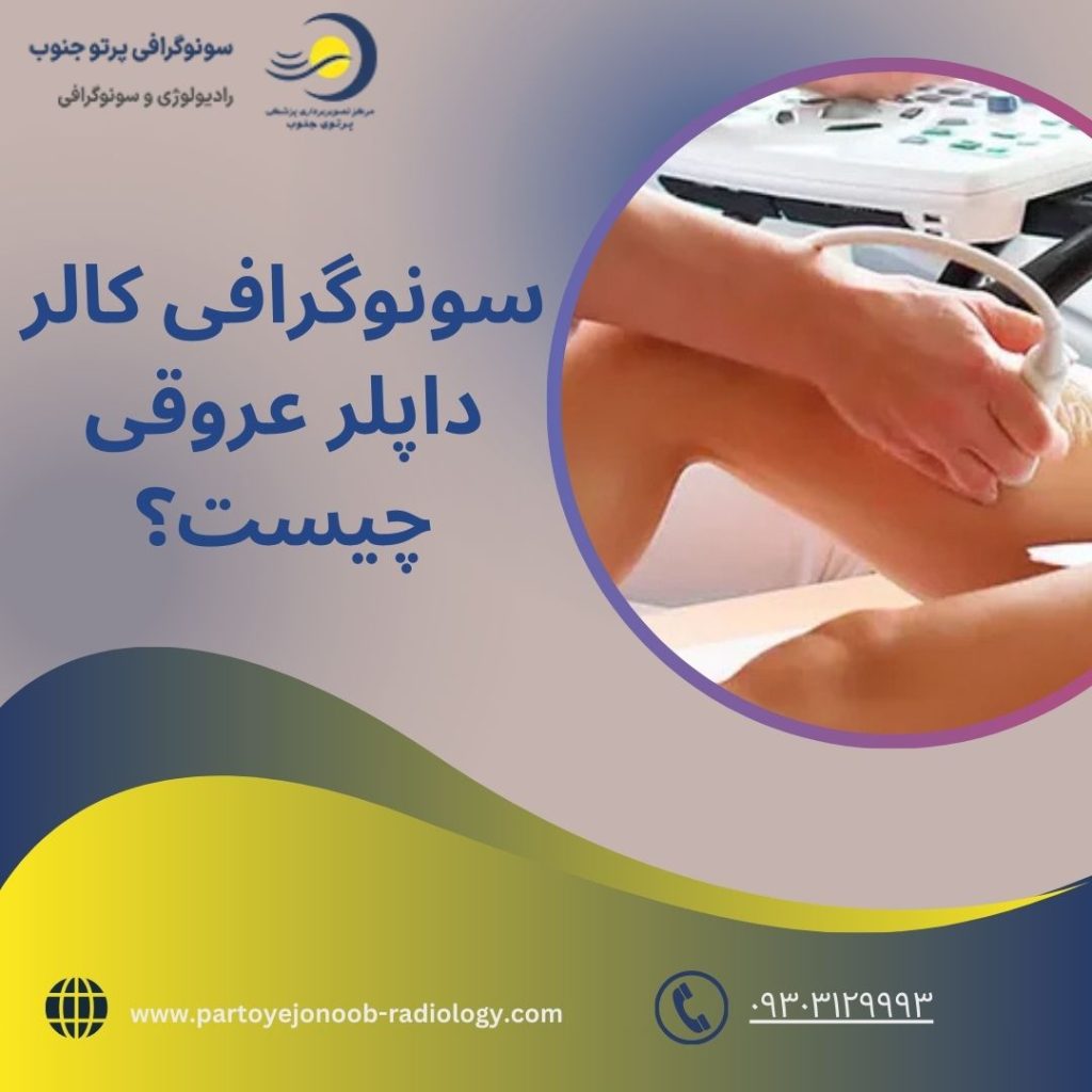 سونوگرافی کالرداپلر عروقی