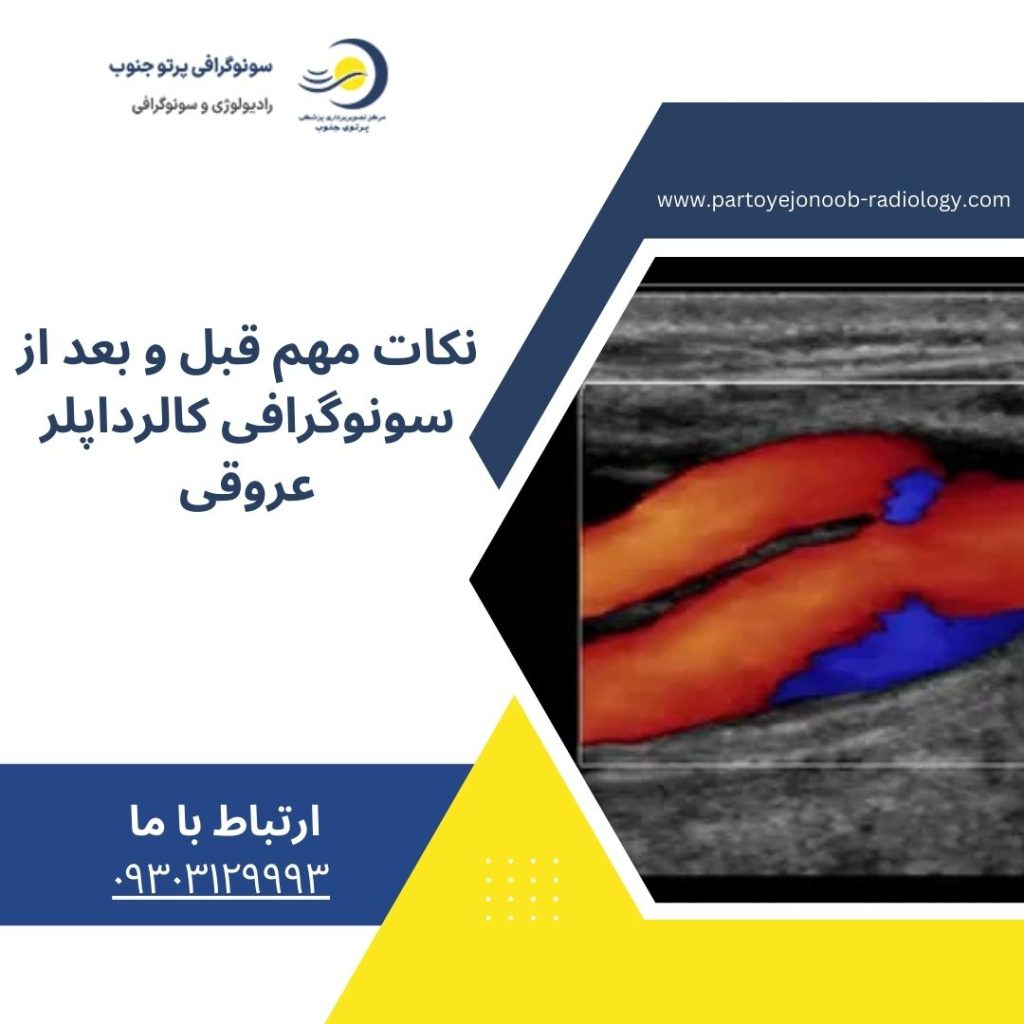 سونوگرافی کالرداپلر عروقی