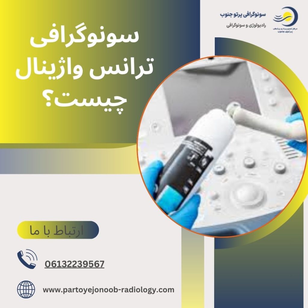سونوگرافی ترانس واژینال