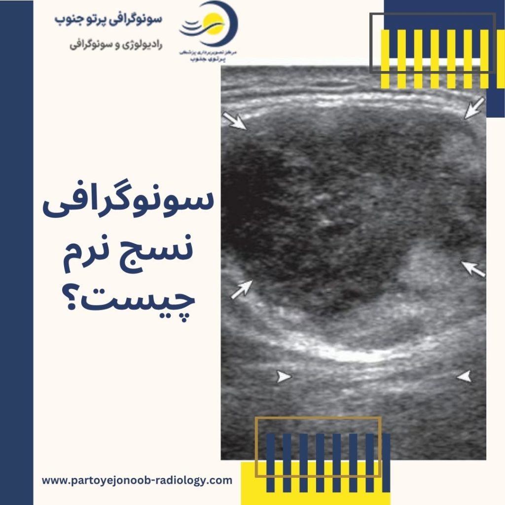 سونوگرافی نسج نرم