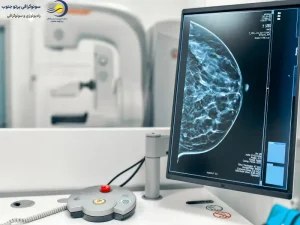 بهترین زمان ماموگرافی