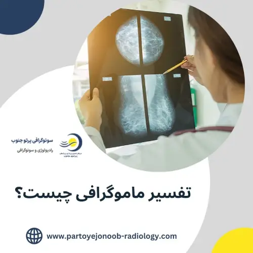 تفسیر ماموگرافی
