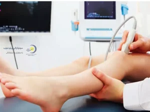 سونوگرافی داپلر عروق پا