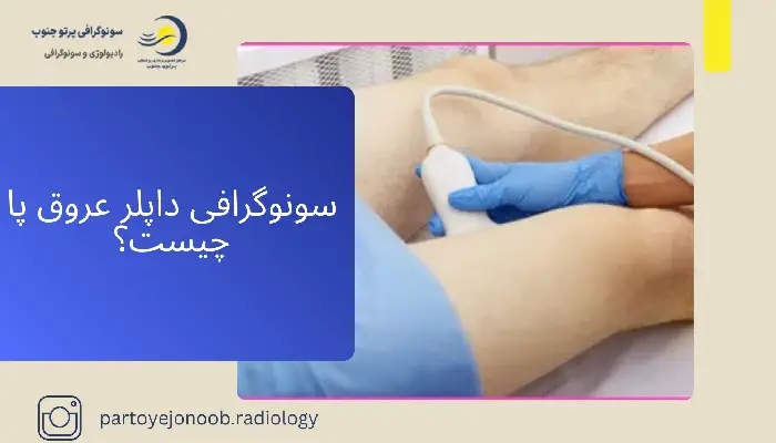 سونوگرافی داپلر عروق پا