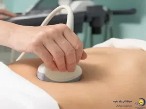 سونوگرافی مثانه