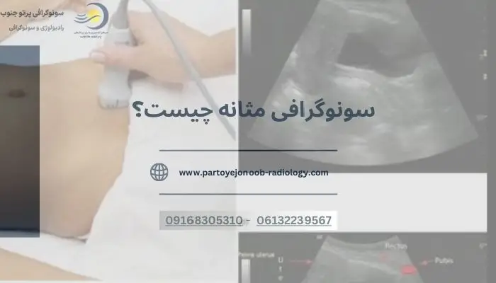 سونوگرافی مثانه