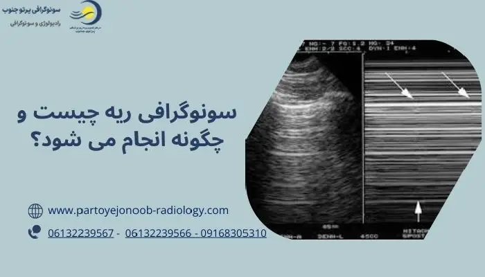 سونوگرافی ریه