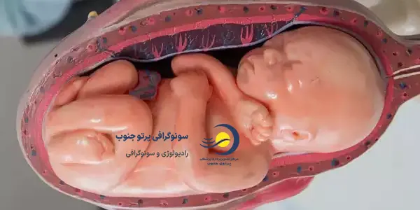 علت چسبندگی جفت