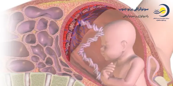 چسبندگی جفت
