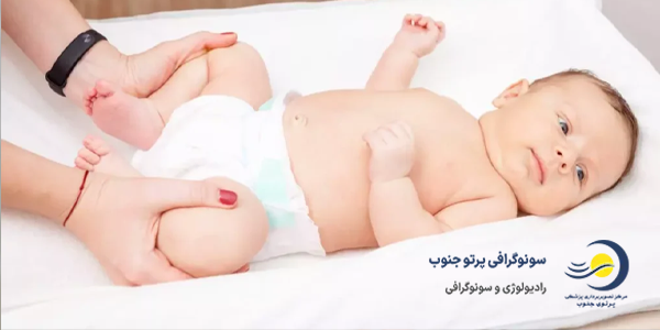 سونوگرافی هیپ نوزادان