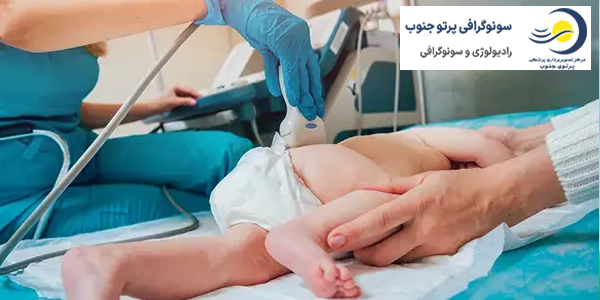 سونوگرافی هیپ نوزادان