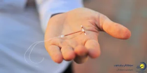 حاملگی با IUD