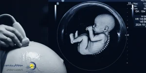 سونوگرافی تعیین جنسیت