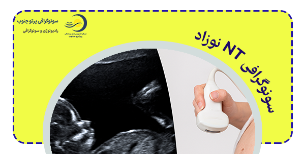 چه زمانی سونوگرافی NT نوزاد نیاز است